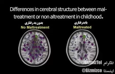 اسکن مغزی فردی جوان که