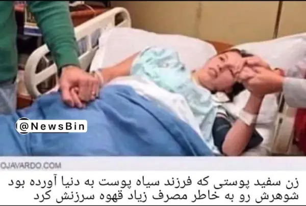 پشمام سوخت    