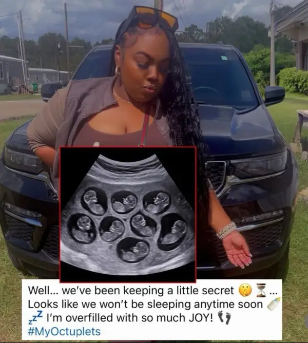 عکس سونوگرافی این خانم که 