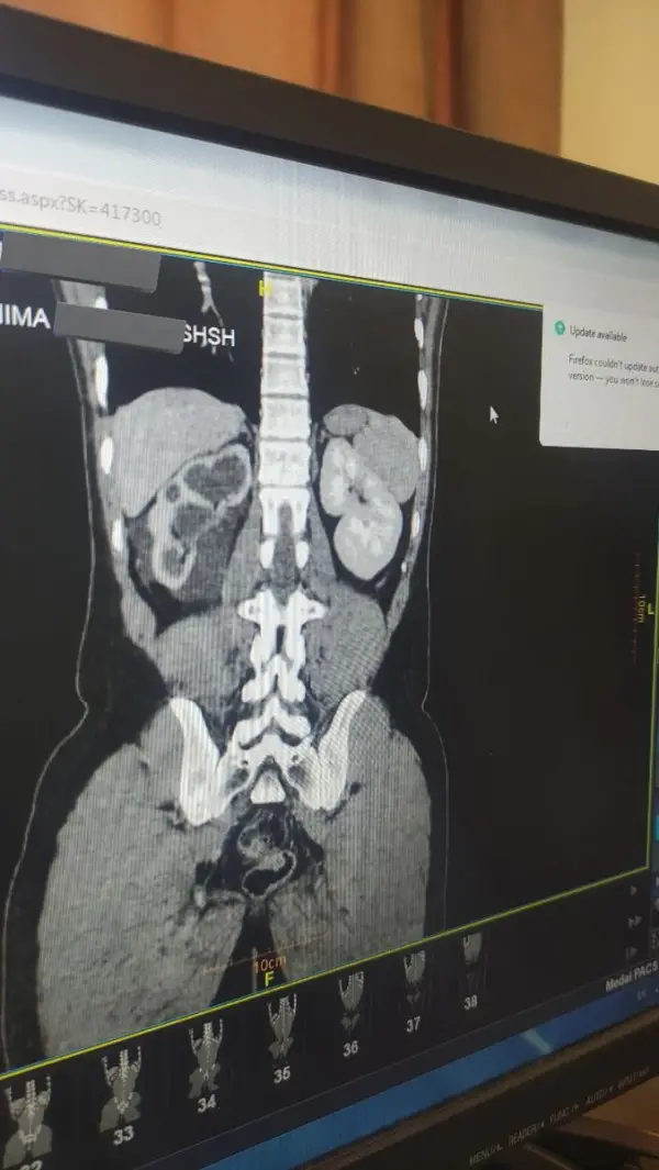 بیمار بخت برگشته پسر ۲۴ 